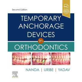 Temporary Anchorage Devices in Orthodontics