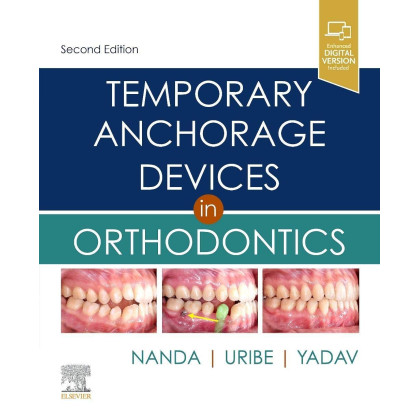 Temporary Anchorage Devices in Orthodontics